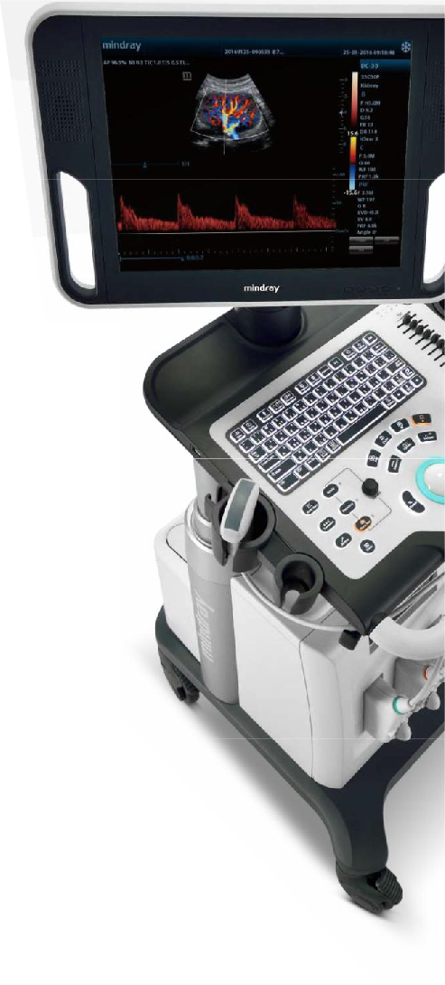 Máy siêu âm mindray dc n3 - Giải pháp hoàn hảo cho chẩn đoán y tế hiện đại
